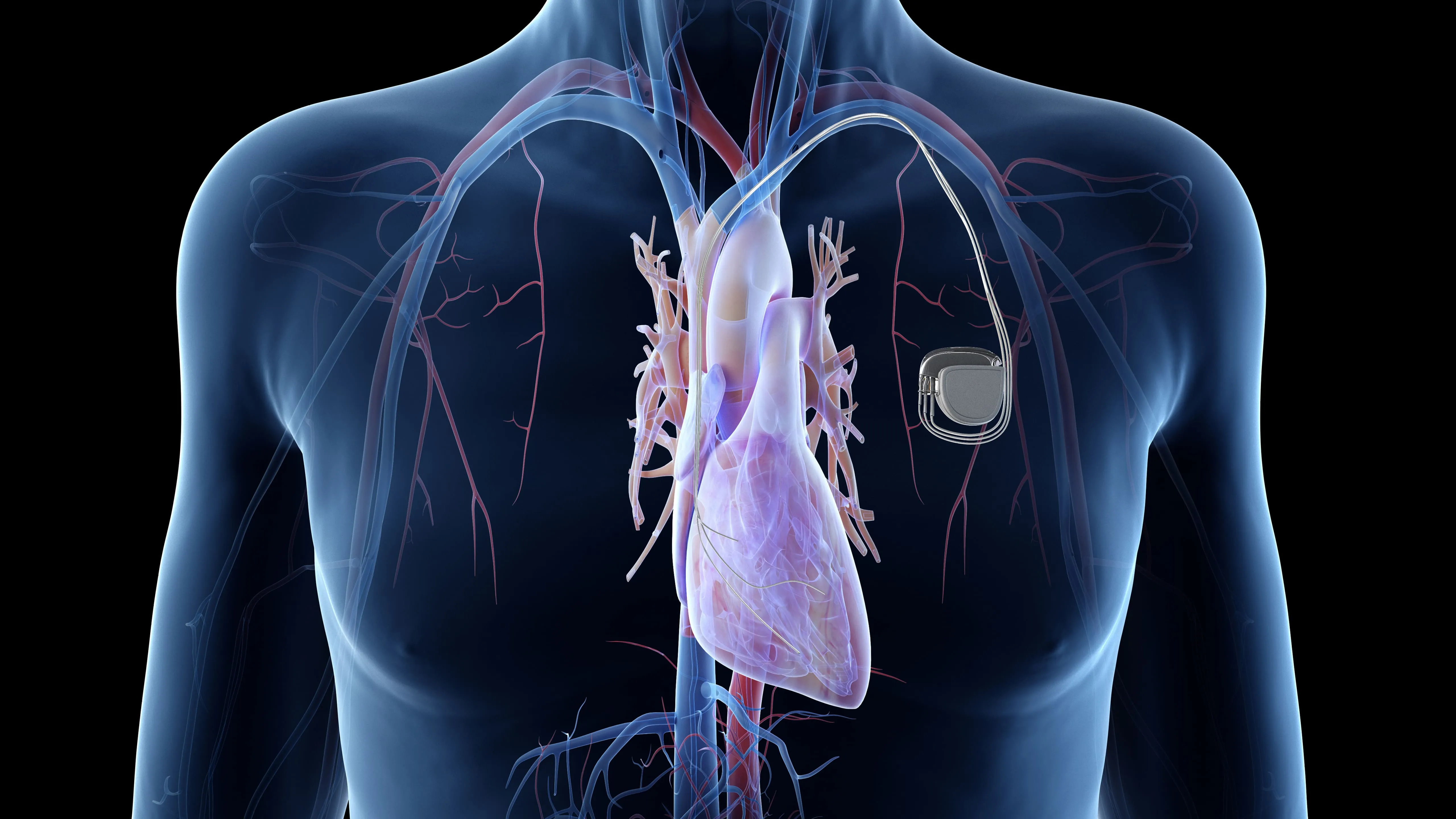 Medical Devices