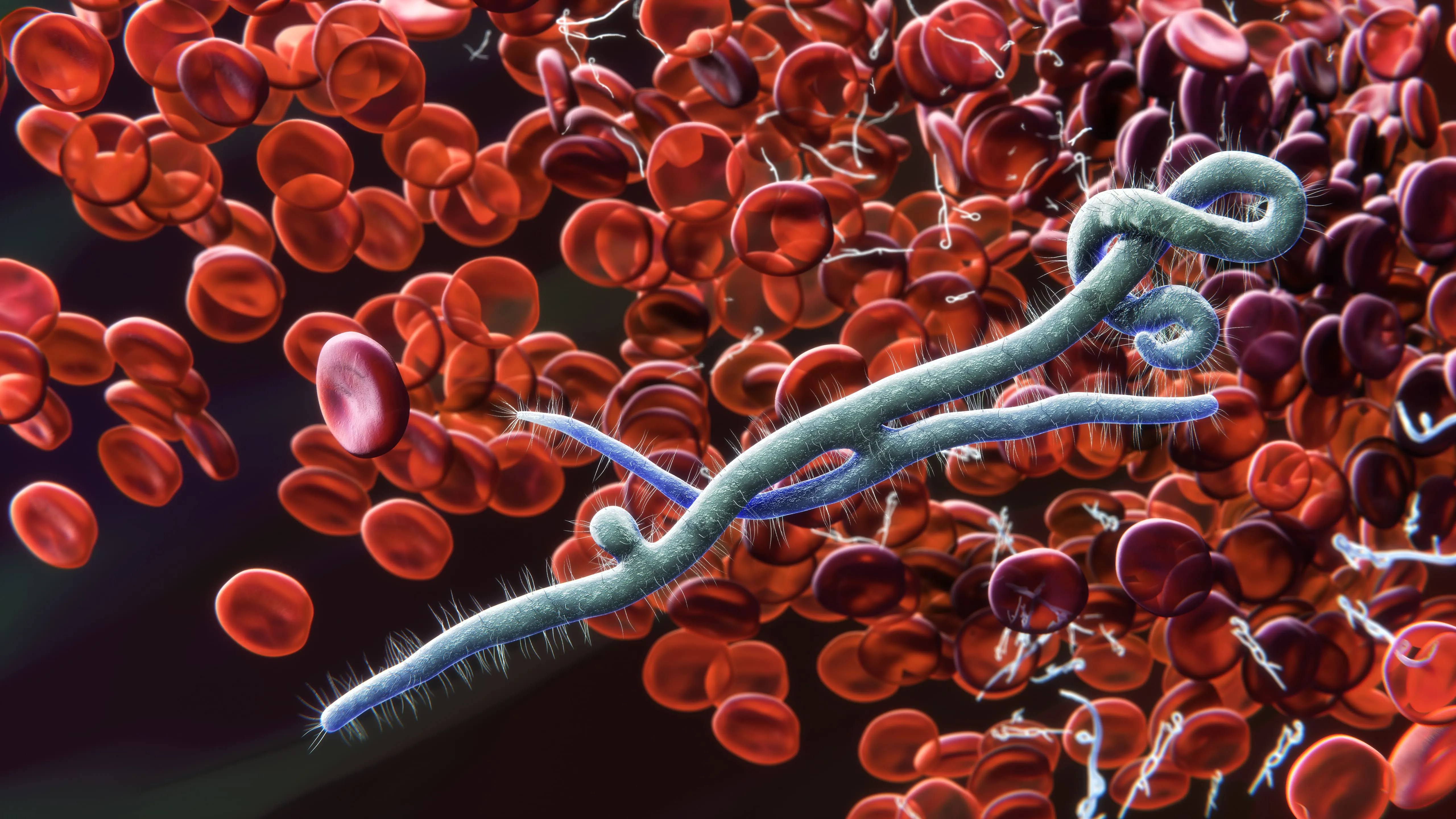 Electron Microscopy
