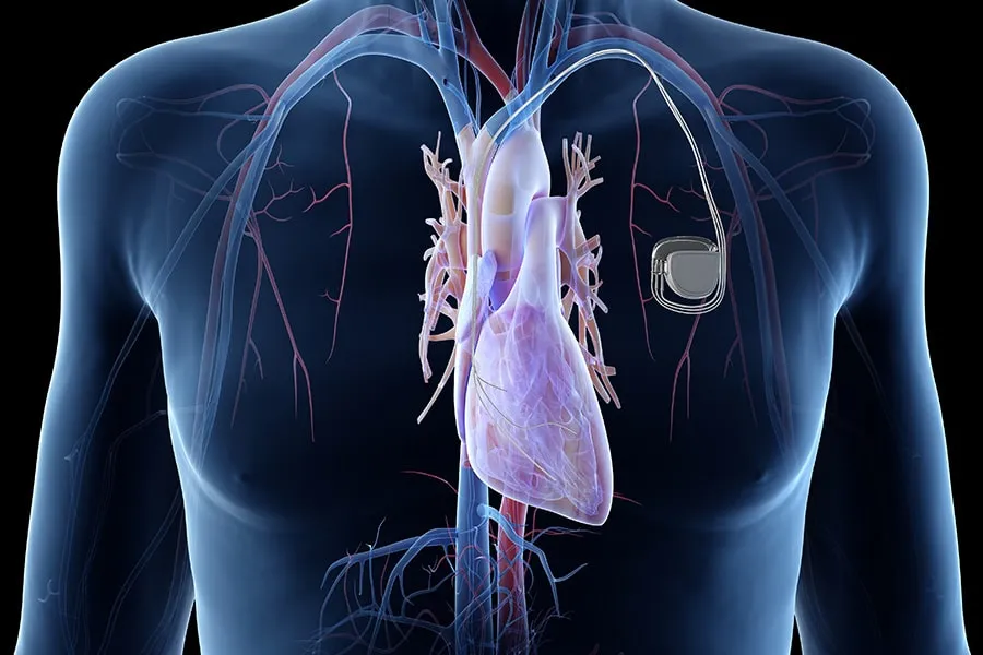 Medical Devices