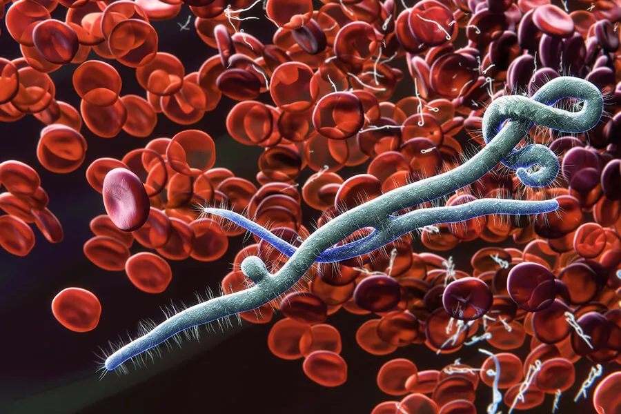 Electron Microscopy